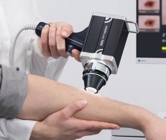 FotoFinder medicam1000